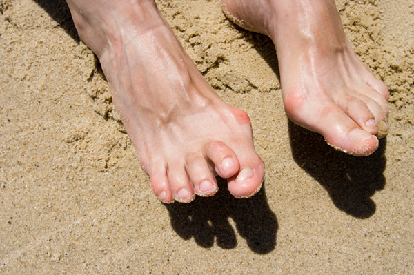 Hammertoes in Howard Beach